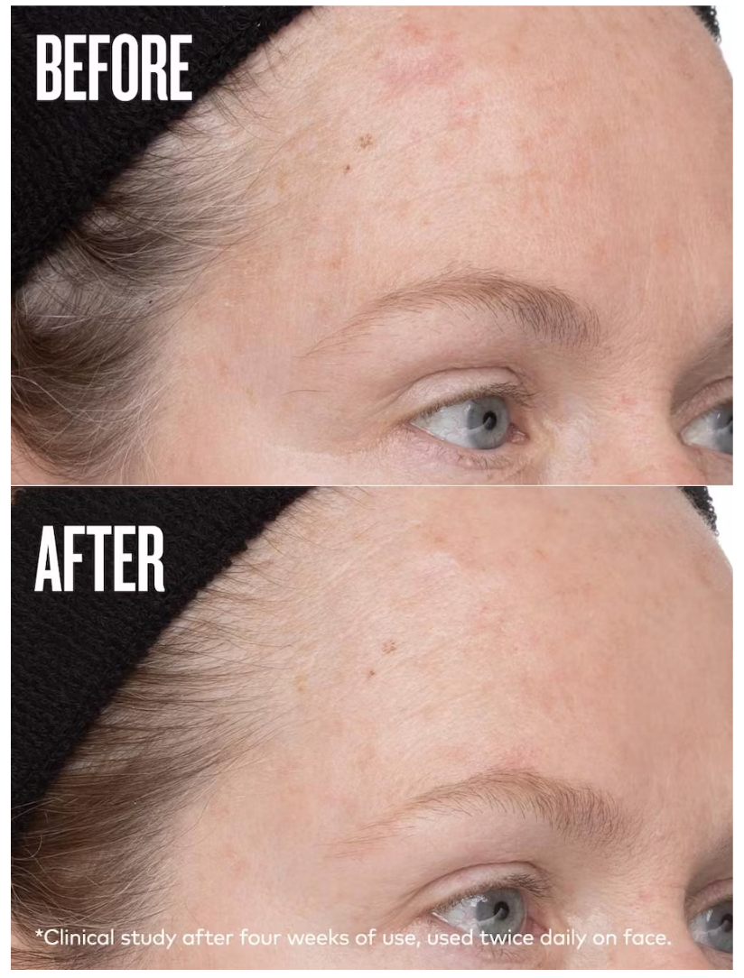 before and after results of using Beautycounter All Bright Dark Spot Minimizer  on the forehead 