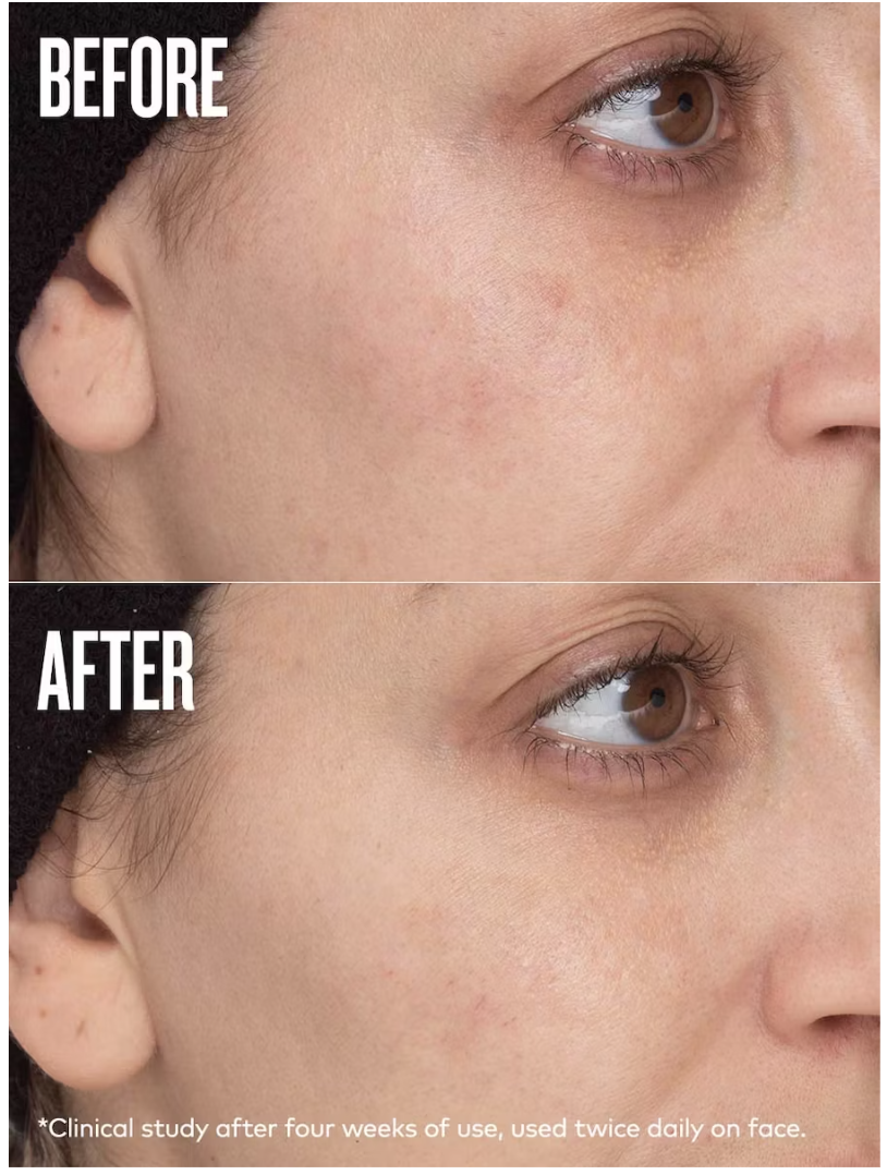 before and after results of using Beautycounter All Bright Dark Spot Minimizer near the eyes