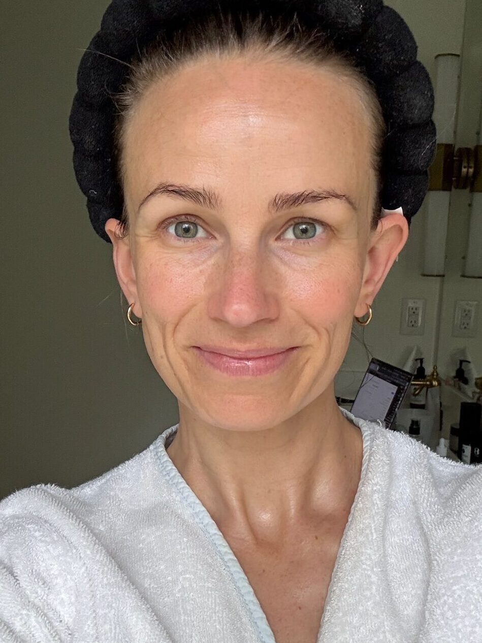 Woman showing close up of face after using vitamin C serum